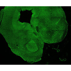 11PCW human midbrain